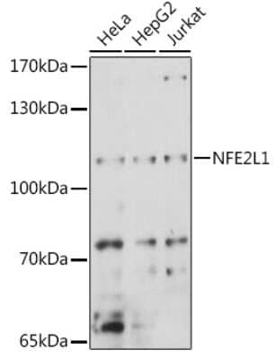 Western Blot: Nuclear Factor Erythroid 2 Related Factor 1 Antibody [NBP2-93792] - Western blot analysis of extracts of various cell lines, using Nuclear Factor Erythroid 2 Related Factor 1 antibody (NBP2-93792) at 1:1000 dilution. Secondary antibody: HRP Goat Anti-Rabbit IgG (H+L) at 1:10000 dilution. Lysates/proteins: 25ug per lane. Blocking buffer: 3% nonfat dry milk in TBST. Detection: ECL Basic Kit. Exposure time: 10s.